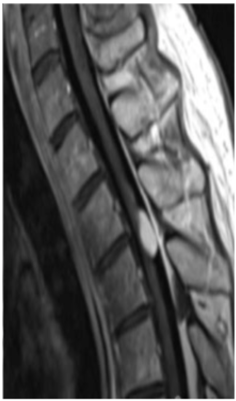 <p>Name the weighting of this sequence and the pathology shown.</p>
