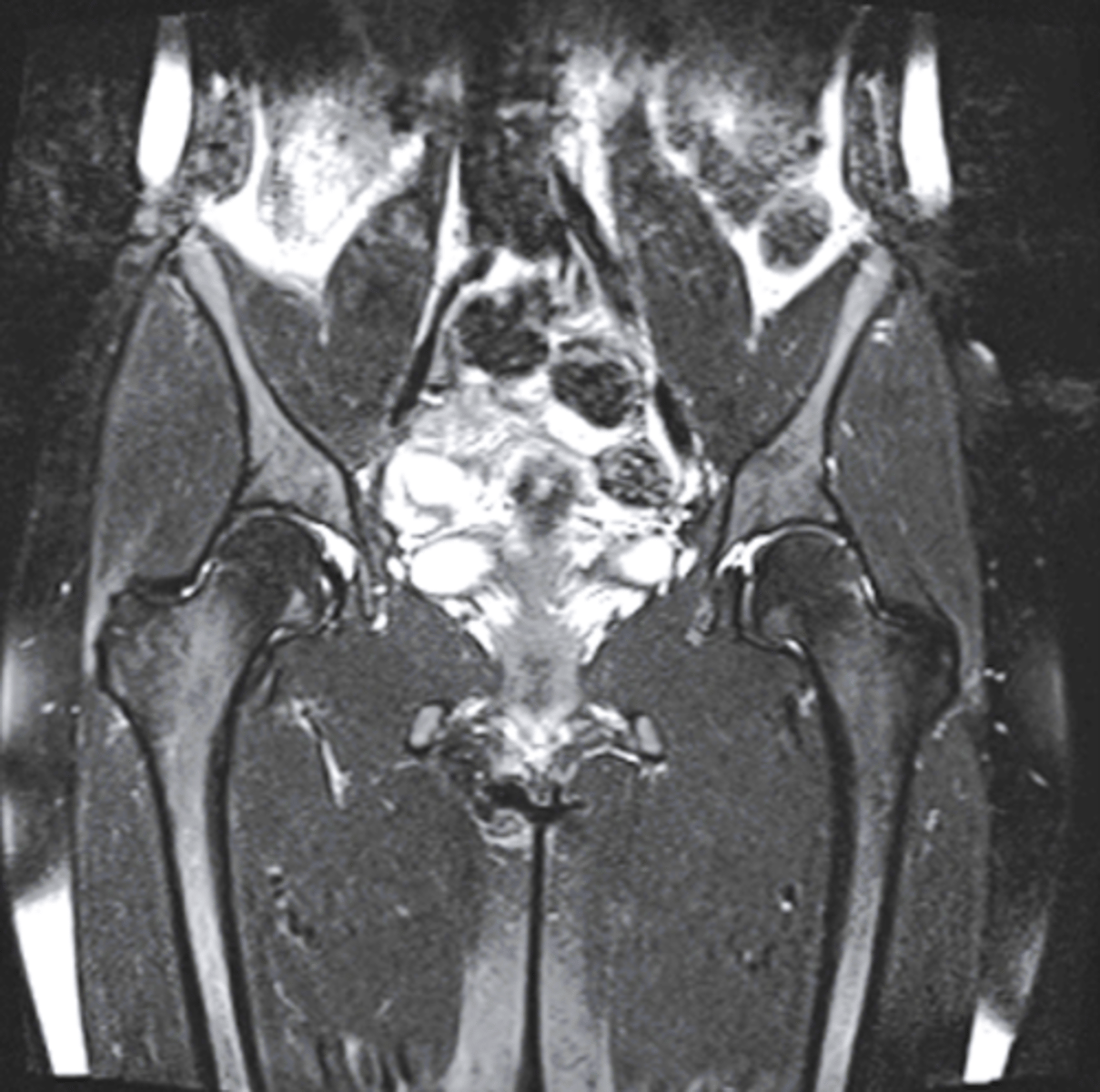 <p>coronal MRI</p><p>3 multiple choice options</p>