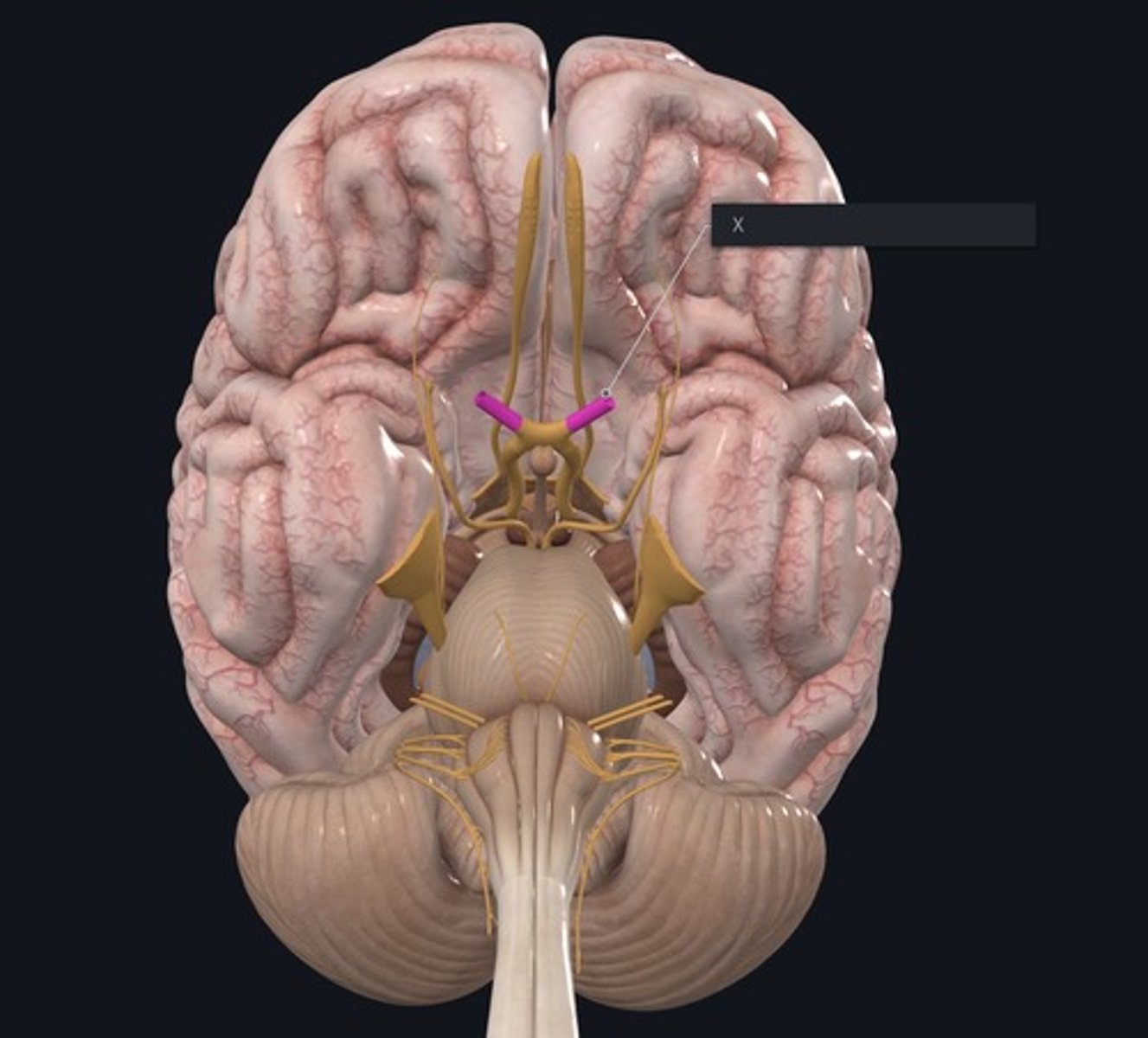 <p>Name the Nerve highlighted purple and indicated by the X.</p>