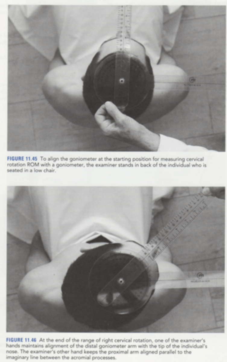 <p>Fulcrum = Center of the cranium</p><p>• Proximal Arm = Parallel to an imaginary line between the two acromial processes</p><p>• Distal Arm = Tip of the nose</p>