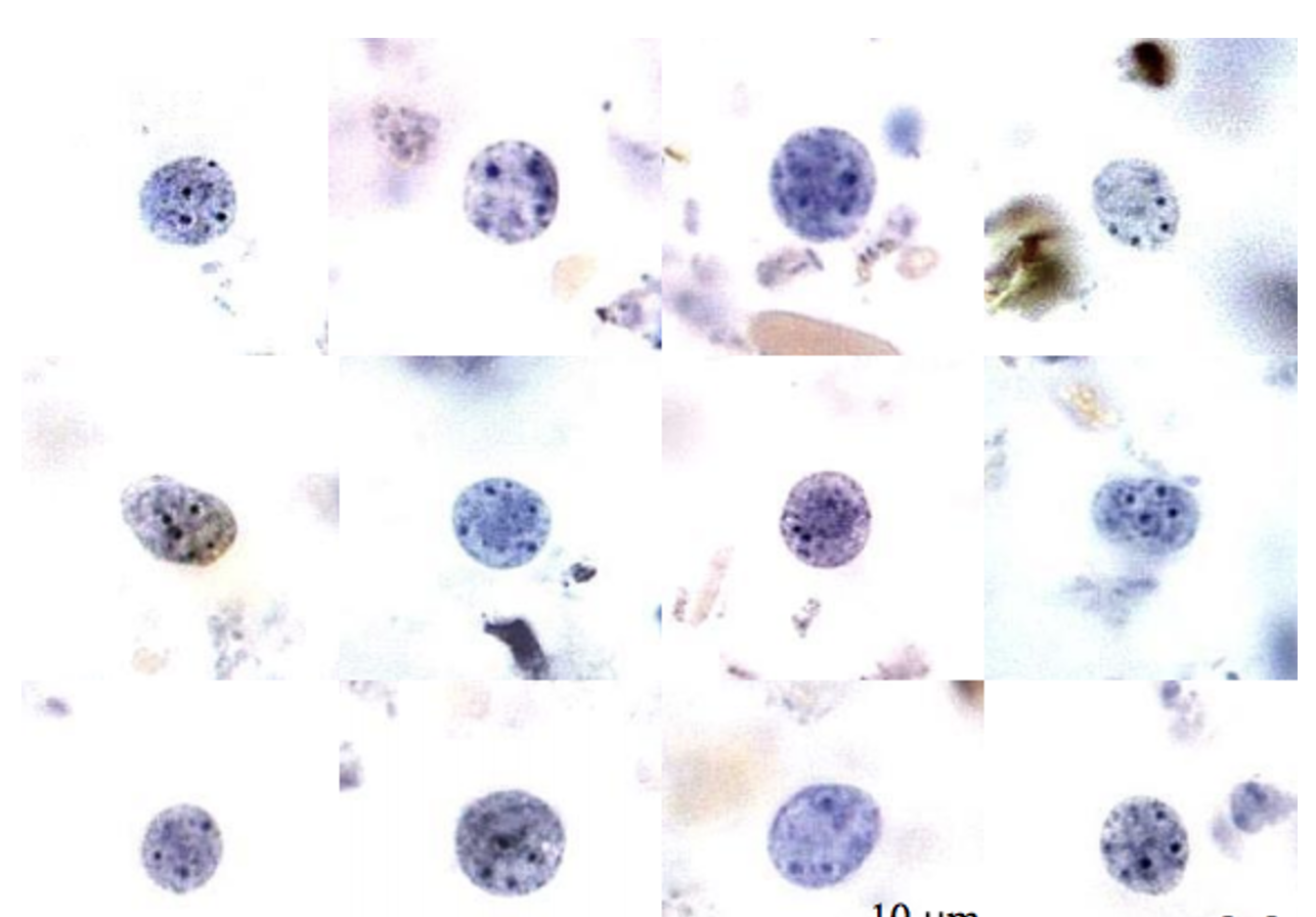 <p>Name: Endolimax nana</p><p class="p1">Stage: cyst</p><p class="p1">*<span><span>Look for four dark endosomes</span></span></p>