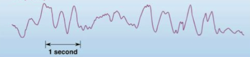 <p>what state of wakefullness/ sleep does this EEG depict?</p>