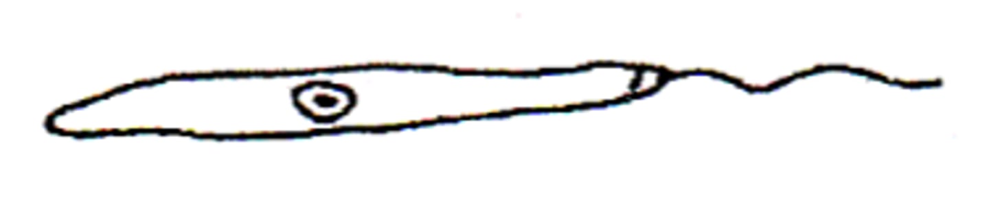 <p>Promastigote (Flagellated)</p>