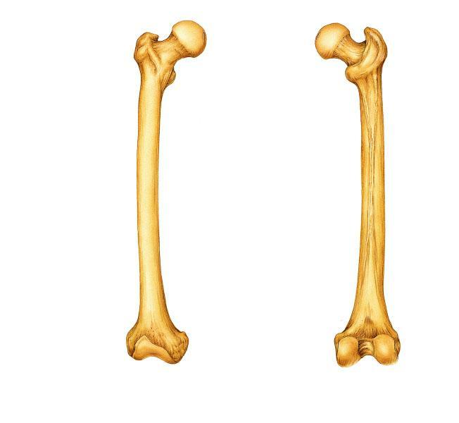 <p>Is the indicated bone from the right or left side of the body?</p>