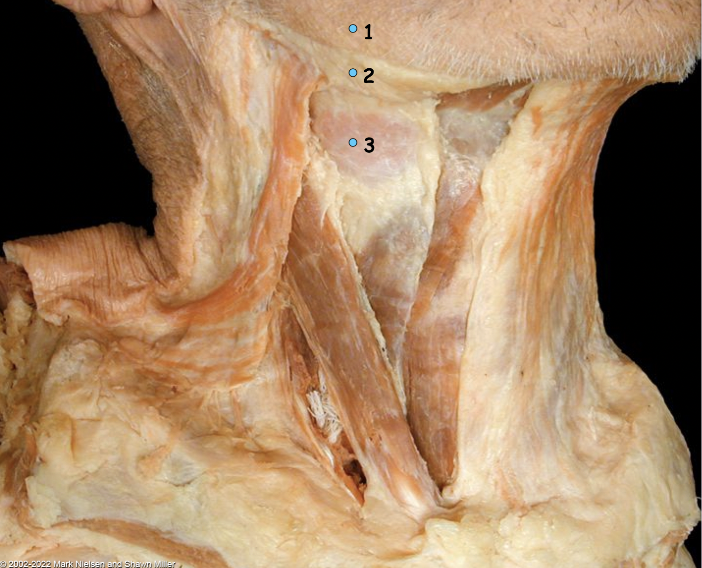 <p>What is number 2?</p>