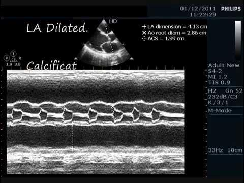<p>What does this m-mode image show?</p>