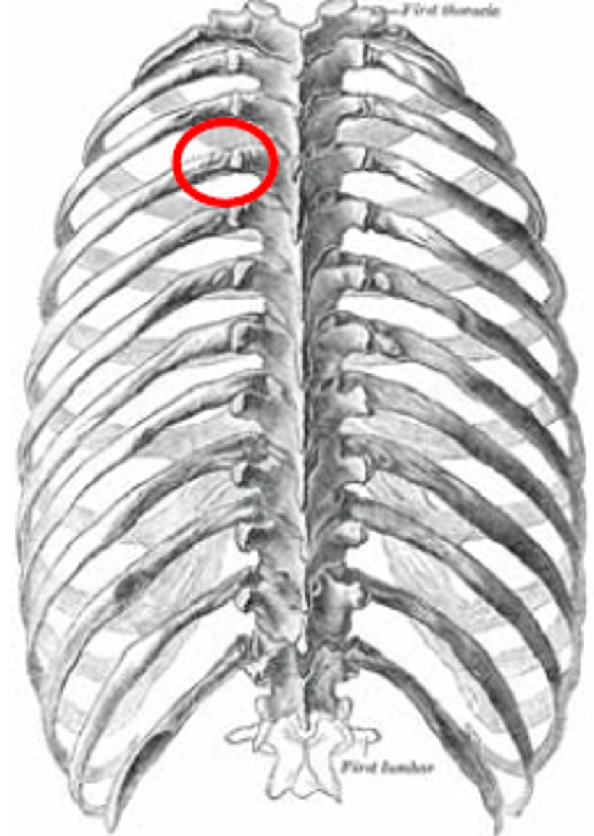 <p>formed on the body of the vertebra and on the transverse process</p>