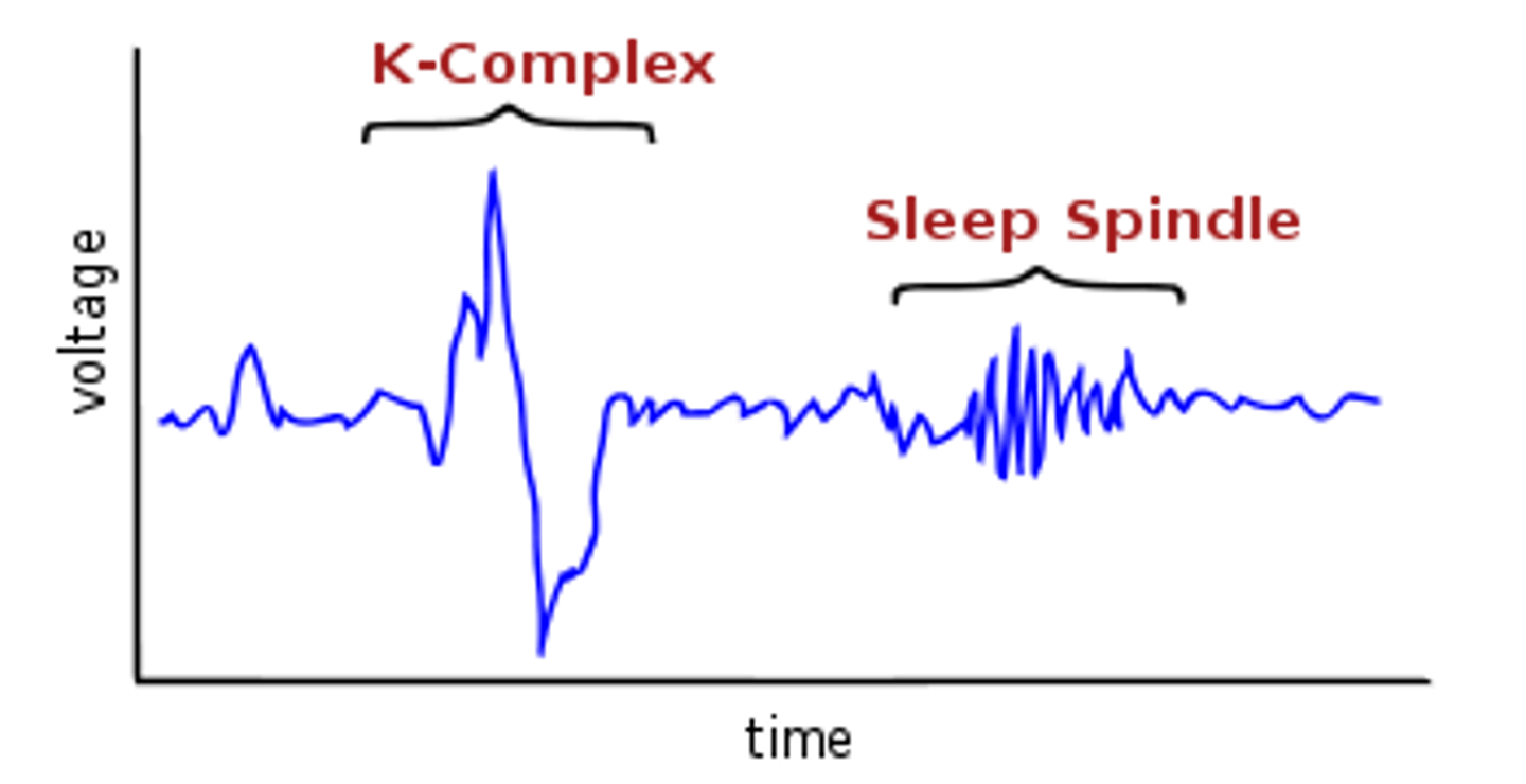 <p>sudden, short increase then decrease in brain activity</p><p>(N-REM 2)</p>