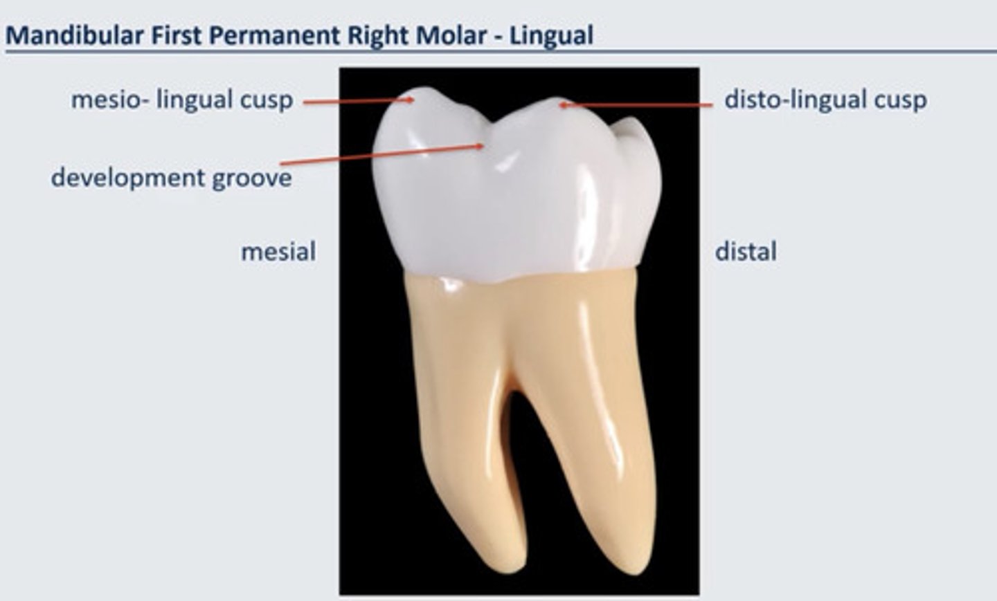 <p>mesiolingual, distolingual, distobuccal</p>