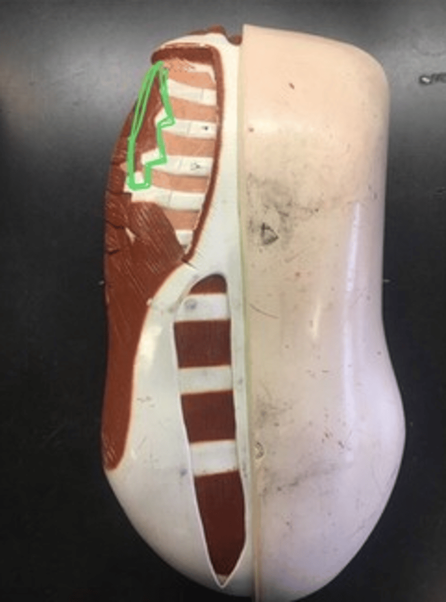 <p>under pectoralis major; individually on ribs</p>