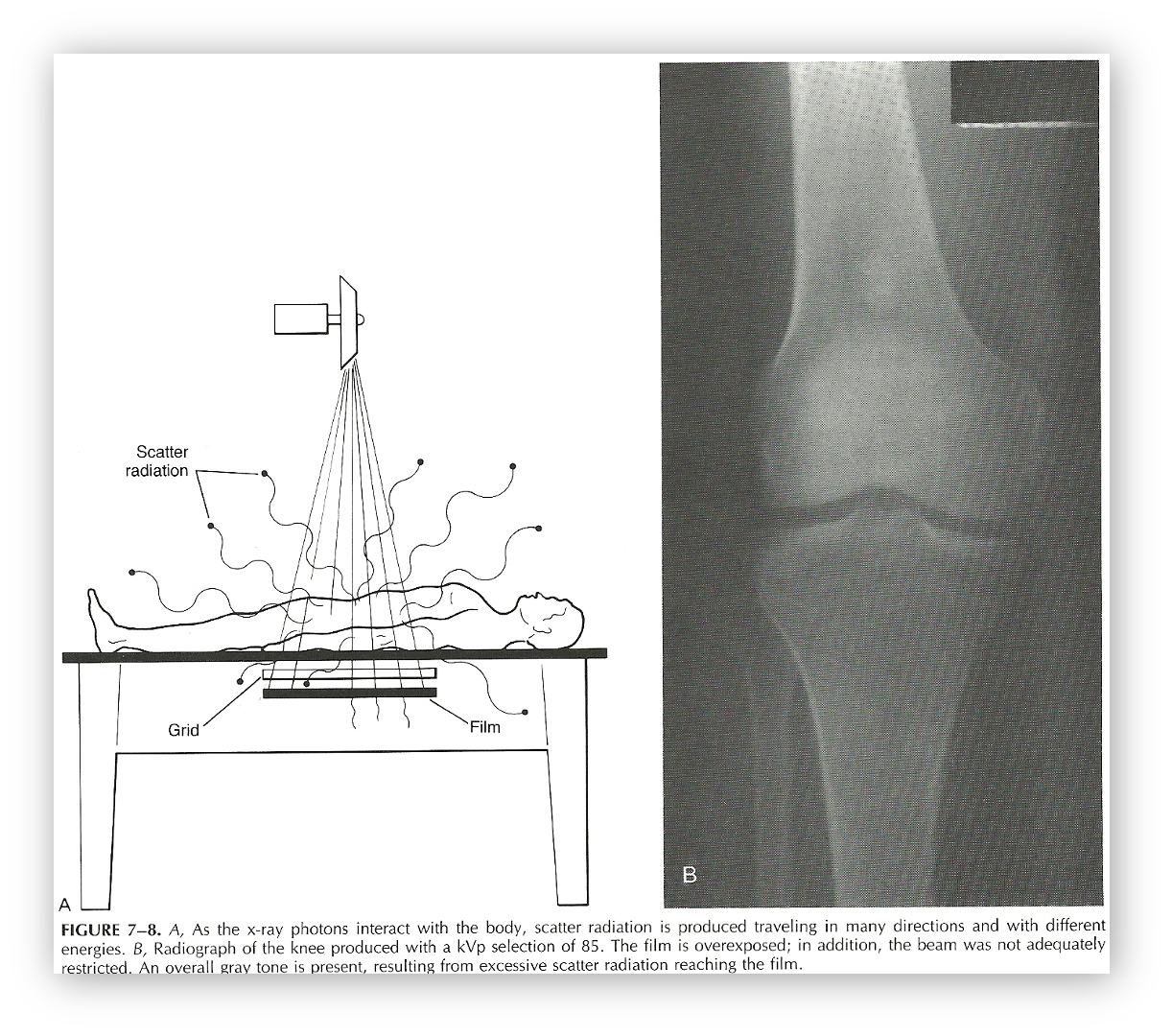 <p><span>Scatter radiation is… </span></p>