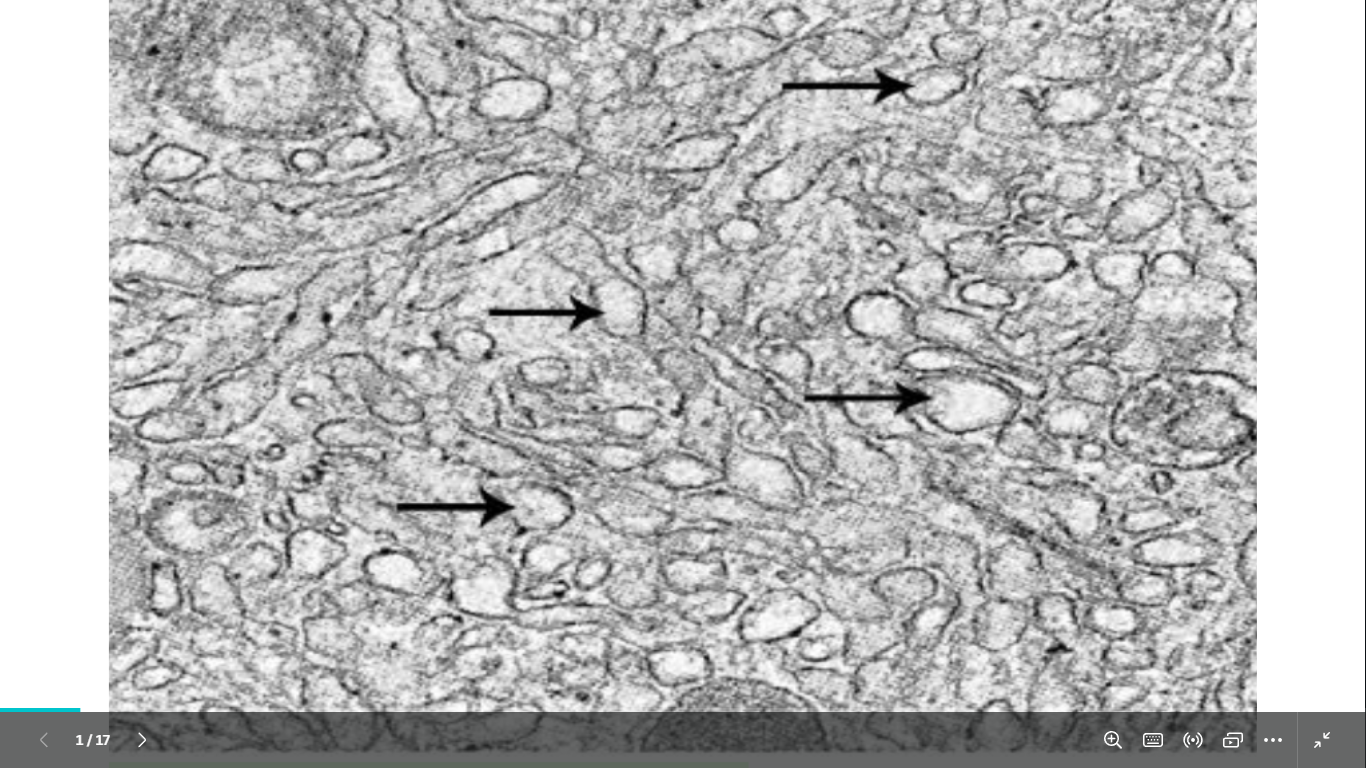 <p>identify </p><p>mention 2 functions </p><p>mention the organs rich in this organelle</p>