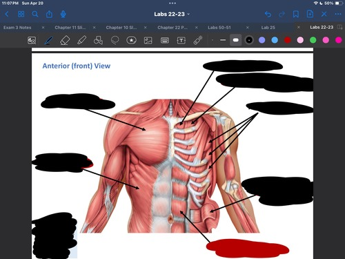 <p>What muscle is this?</p>