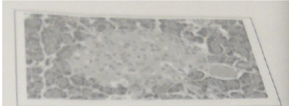 27\. The structure indicated by the arrows