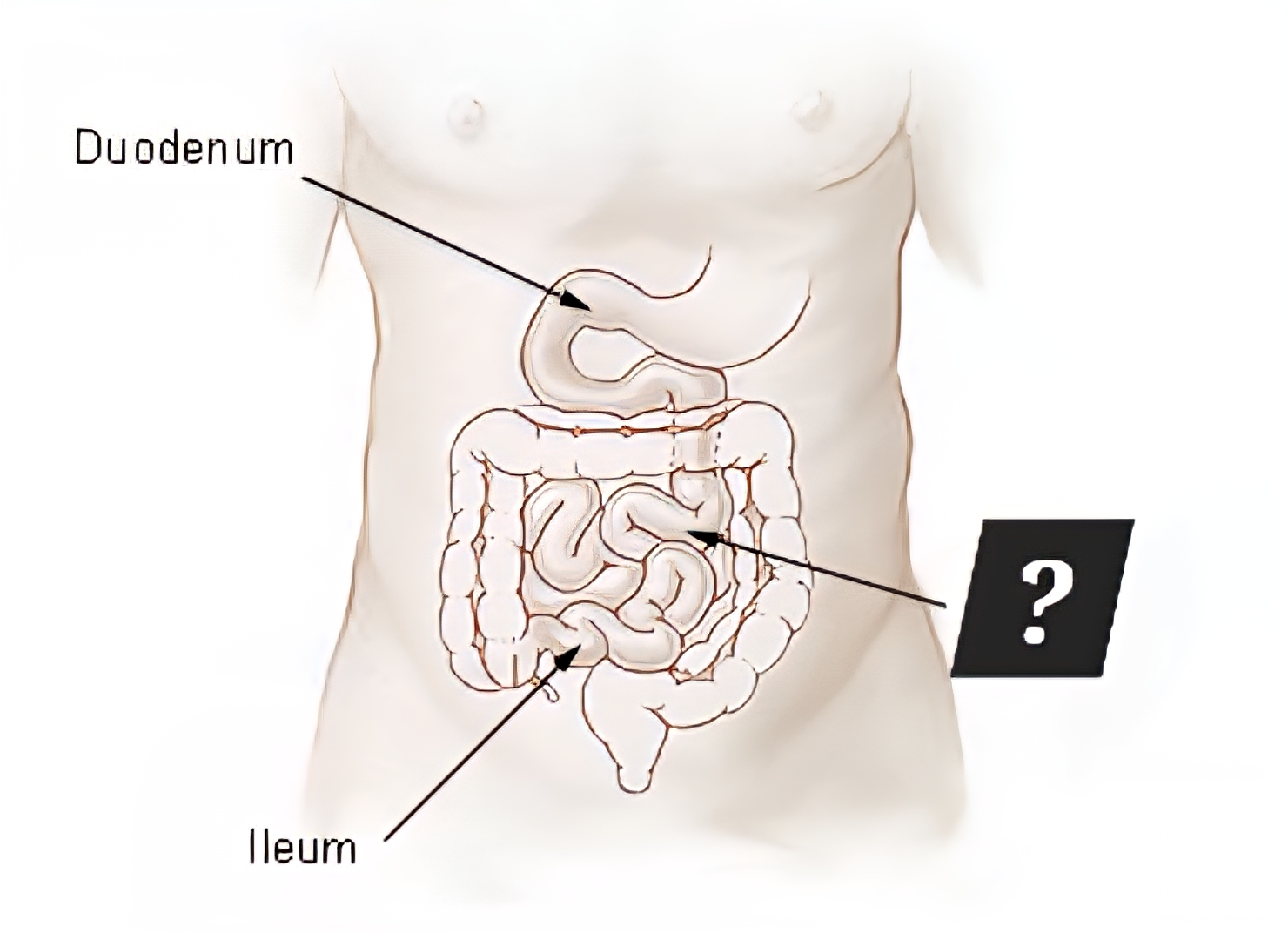 <p>Function?</p>