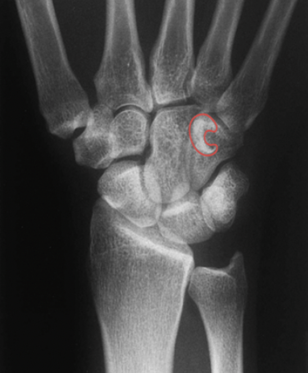 <p>What structure is highlighted?</p>