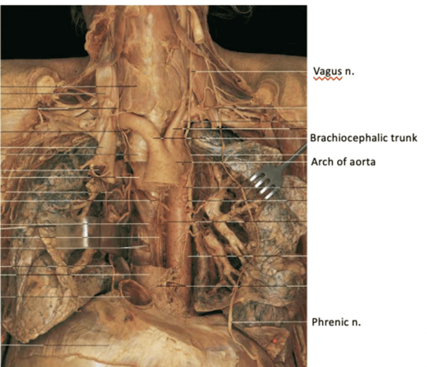 <p>at lateral borders of anterior scalene muscles (by union of fibers from C3, 4, and 5)</p><p>-descend anterior to the anterior scalene mm</p><p>-proceed between the subclavian artery and subclavian vein on each side to enter the thorax. They supply the diaphragm</p>