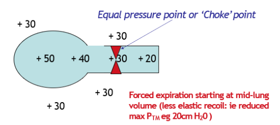 <ul><li><p><span>4 factors are not working together to create a large P<sub>TM</sub></span></p></li><li><p><span>Lower elastic recoil and generates a lower +ve intrapleural pressure e.g., 30 cm H<sub>2</sub>O</span></p><ul><li><p><span>Generates a lower P<sub>A</sub> (P<sub>A </sub>= P<sub>el</sub>+ P<sub>pl</sub>)</span></p></li></ul><p></p></li><li><p><span>Therefore max Transmural pressure is lower (P<sub>TM</sub> = P<sub>el</sub>) = 20 cm H<sub>2</sub>O&nbsp;</span></p><p></p></li><li><p><span>Results in intrapleural pressure equalling airway pressure at some point in the smaller air ways (no cartilage) = choke point</span></p></li></ul>