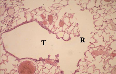 <p>Identify this structure</p>