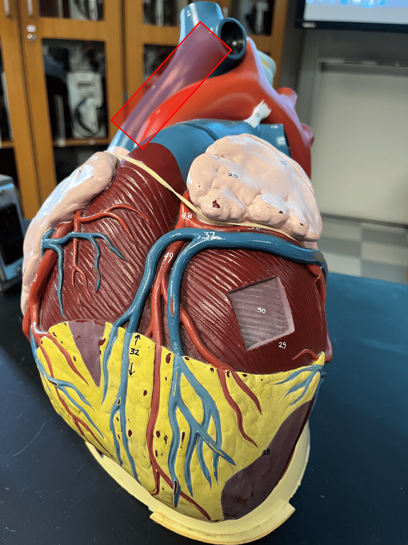 • A great vessel of the heart.

• Carries deoxygenated blood to the right atrium from areas superior to the heart.

• Abbreviated SVC.