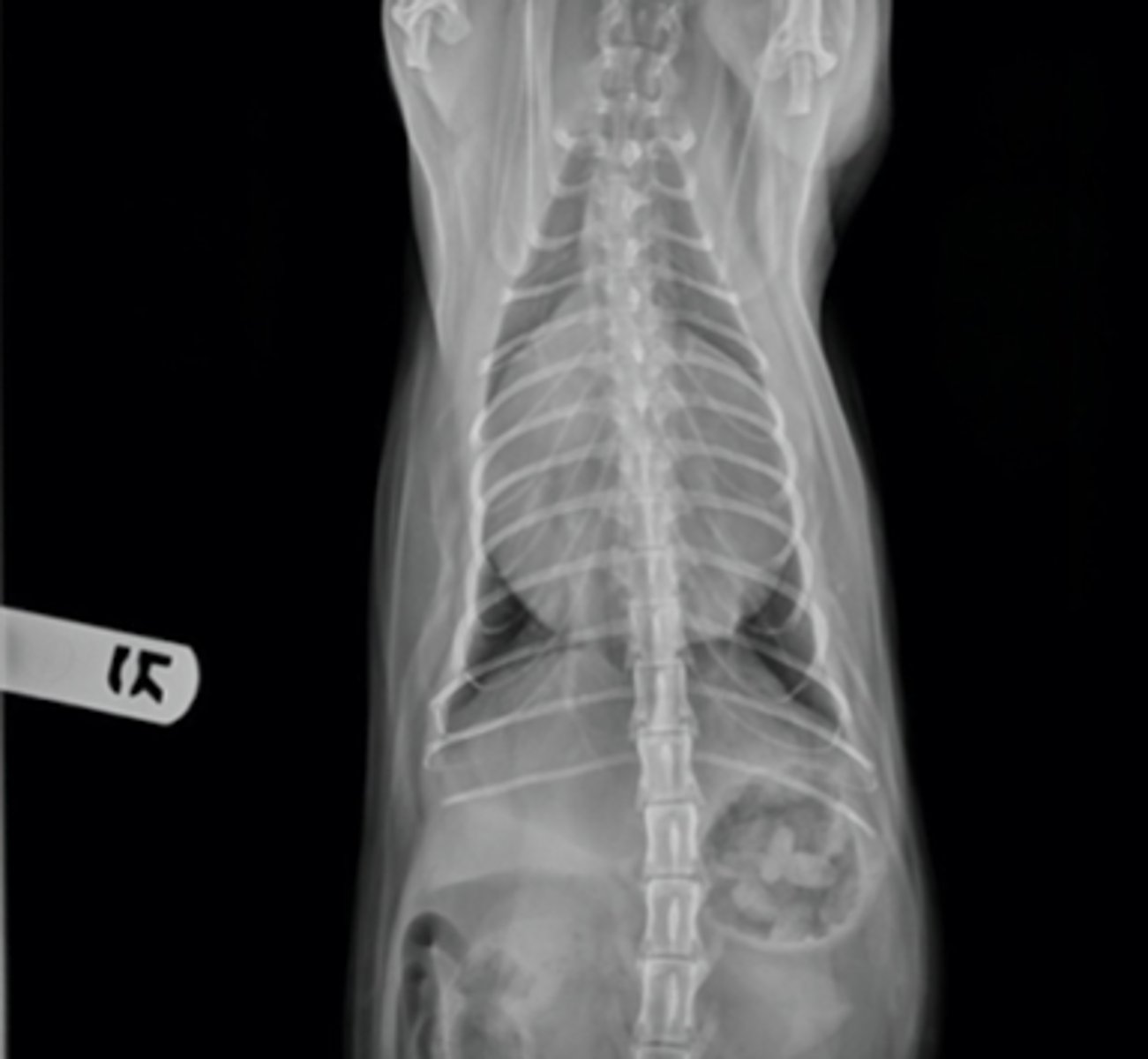 <p>what diagnostic imaging technique was used to create this image?</p>