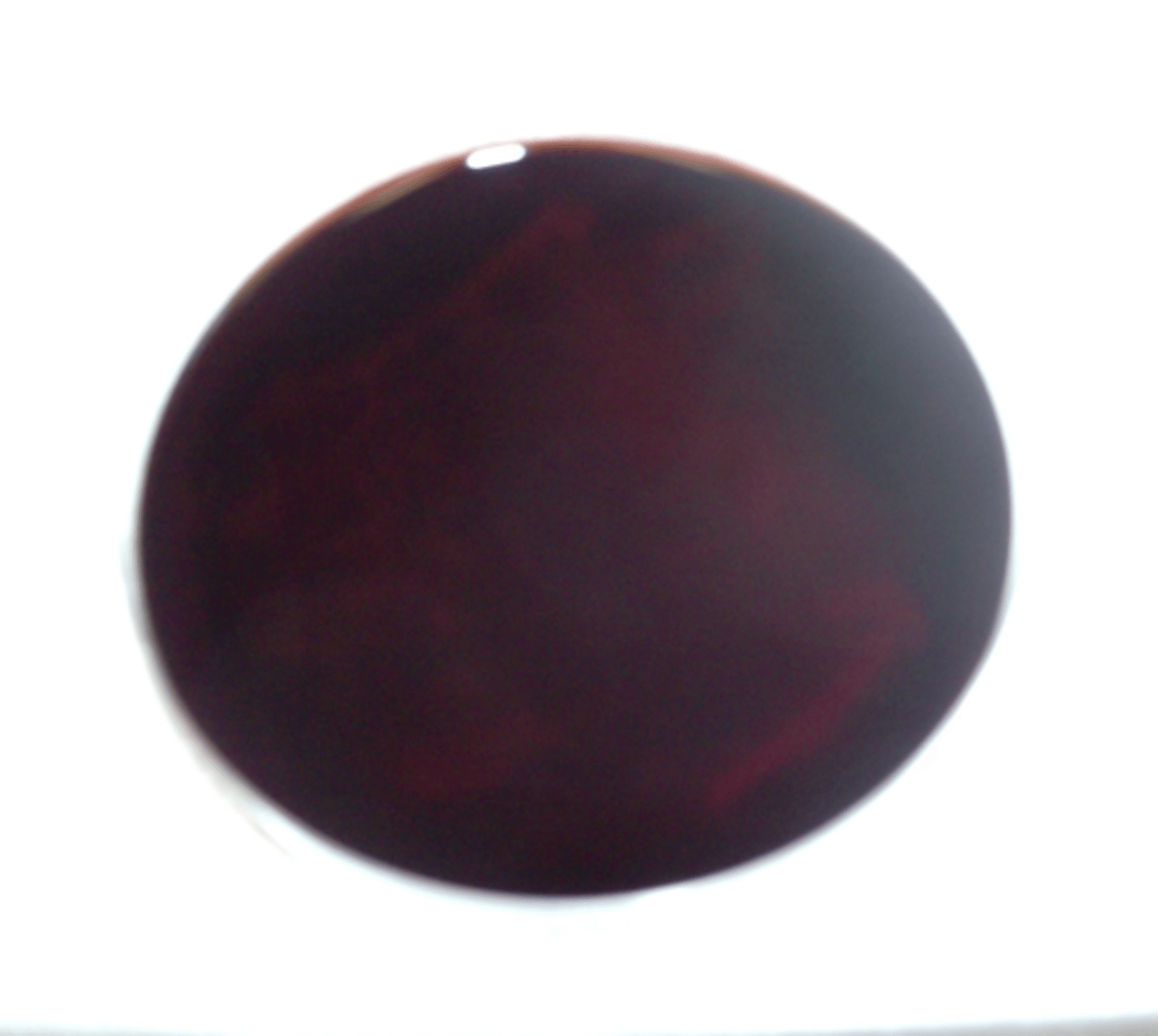 <p>Does not produce amylase - dark even under growth</p>