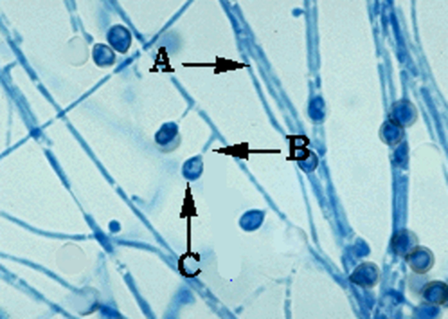 <p>B. dermatitidis</p>