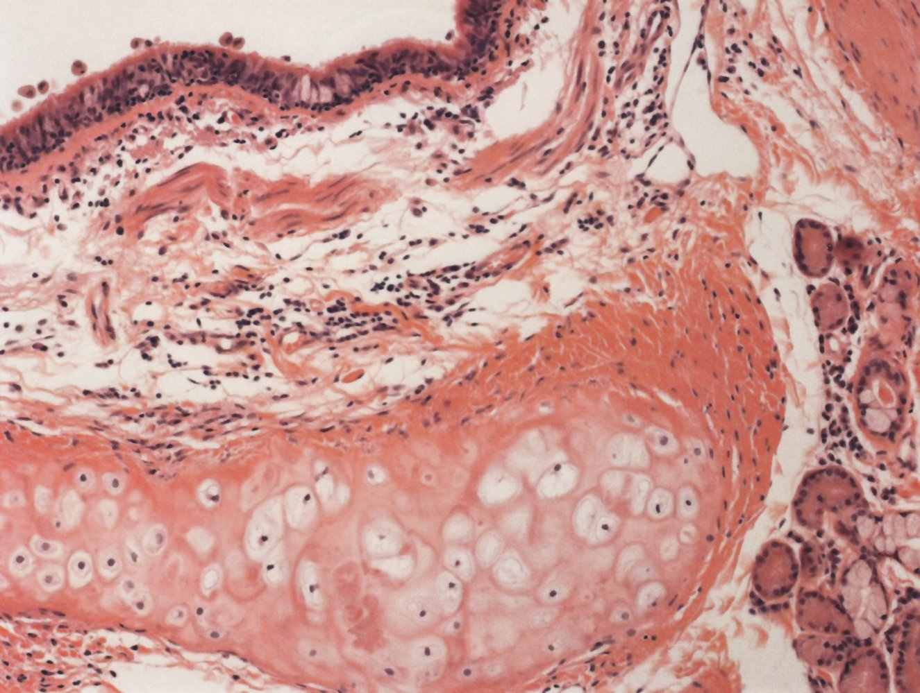 <p>E. Hyaline cartilage</p>