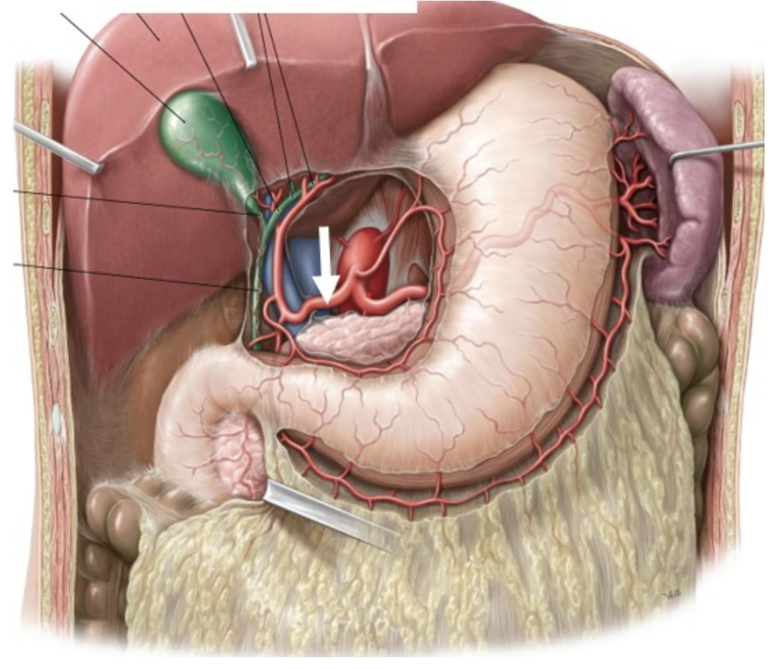 <p><span>Which of the following arteries will be involved in forming the shortest anastomosing route to serve as an alternate channel to maintain hepatic arterial circulation should there be a blockage at the site indicated by the arrow?&nbsp;</span></p>