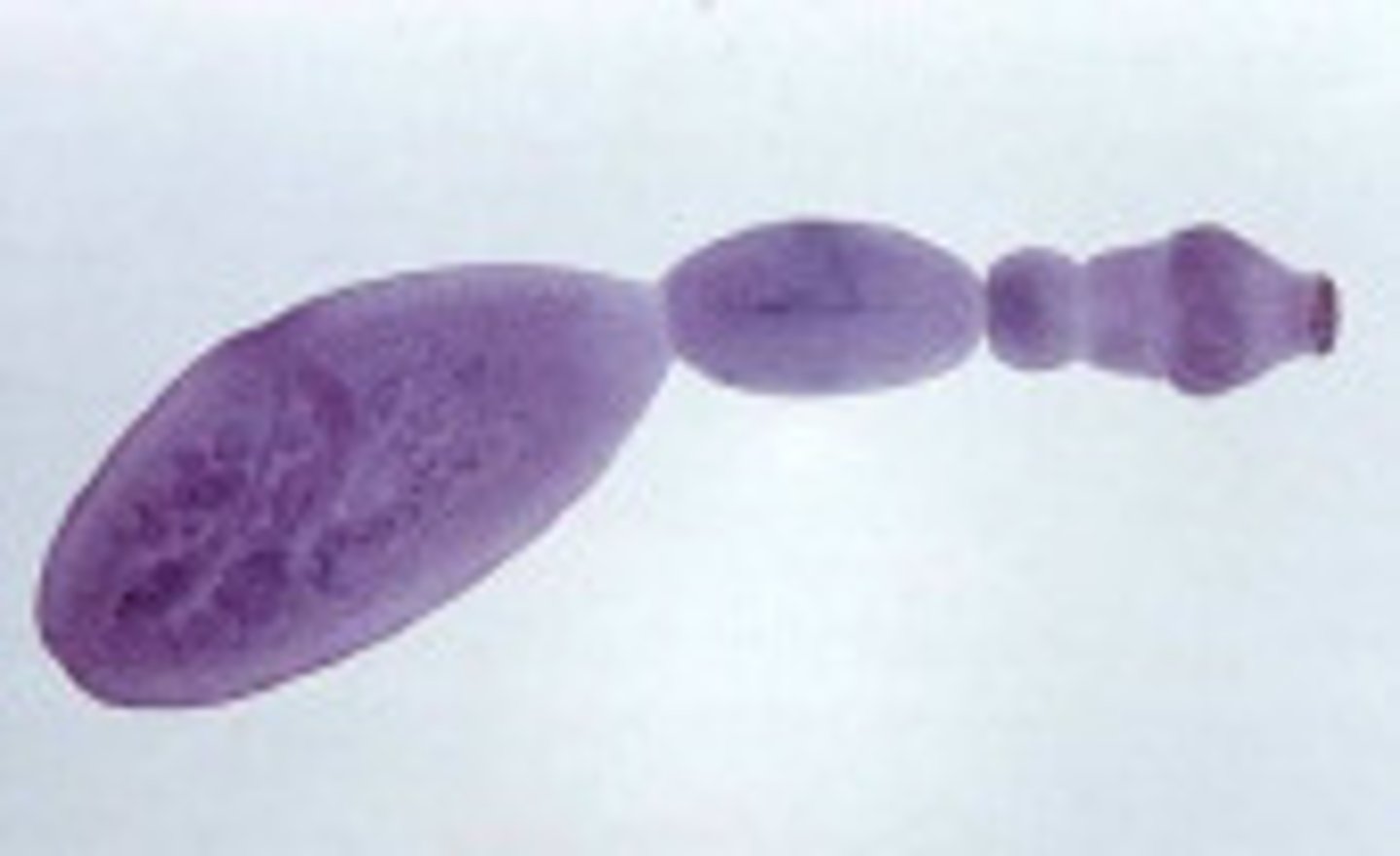 <p>hydatid tapeworm</p>