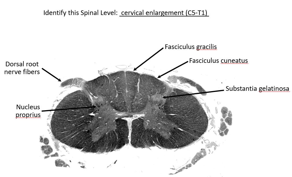 <p>cervical enlargement (C5 - T1)</p>
