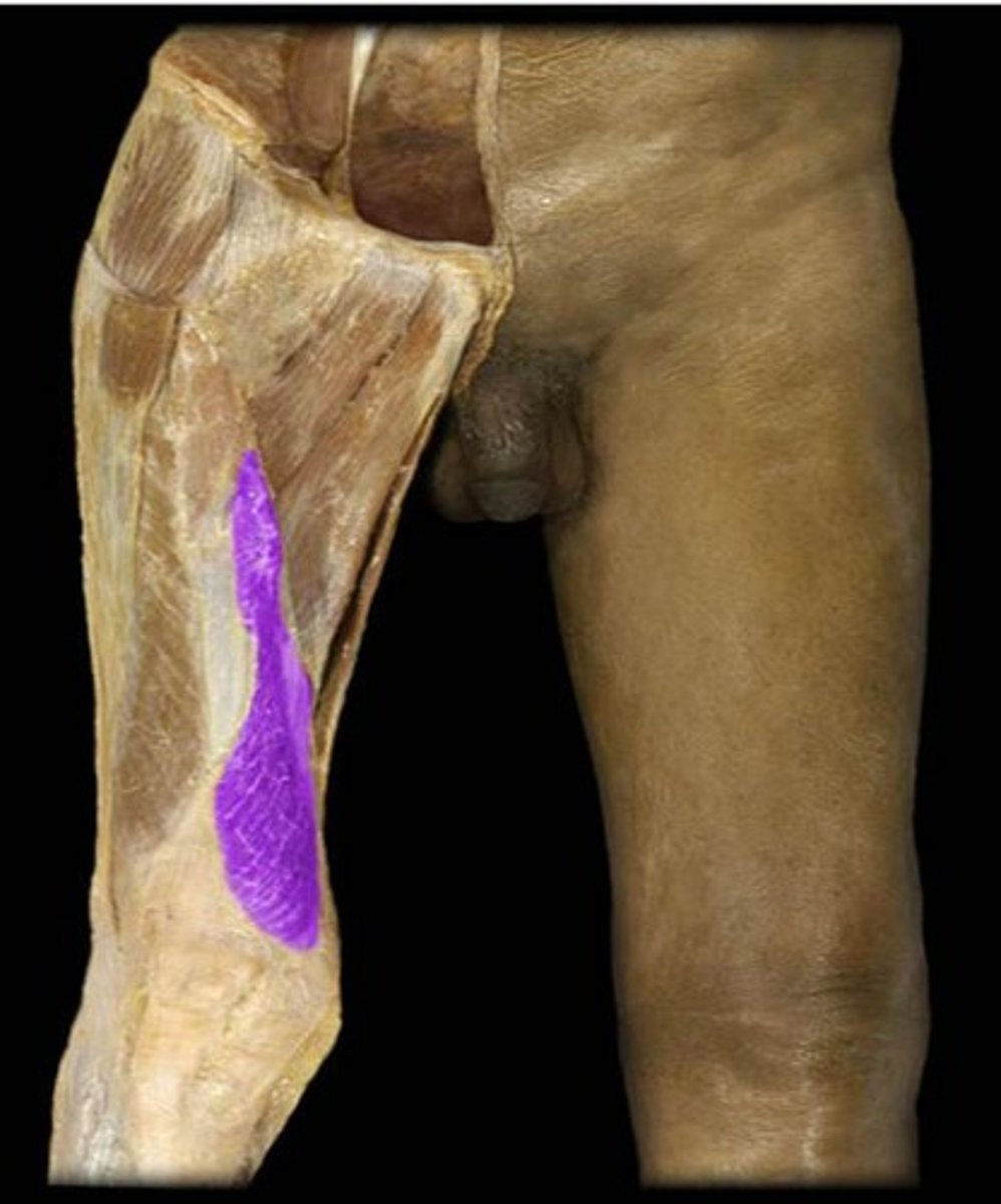 <p>What is the name of this muscle, highlighted in purple?</p>