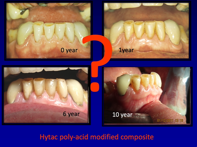 <p>what adhesive was used? serviton cavity seal&nbsp;</p>