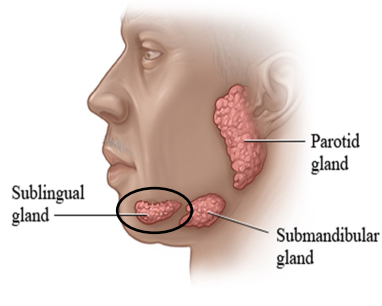 <ul><li><p>Smallest major salivary gland</p></li><li><p>NO CAPSULE</p></li><li><p>mixed glands = mostly mucous </p></li><li><p>Located on the floor of the mouth in the sublingual fossa, anterior to the submandibular gland </p></li></ul><p>Secretions: mainly mucous secretions and little serous; contributes ~10% of total salivary volume. </p><p></p>