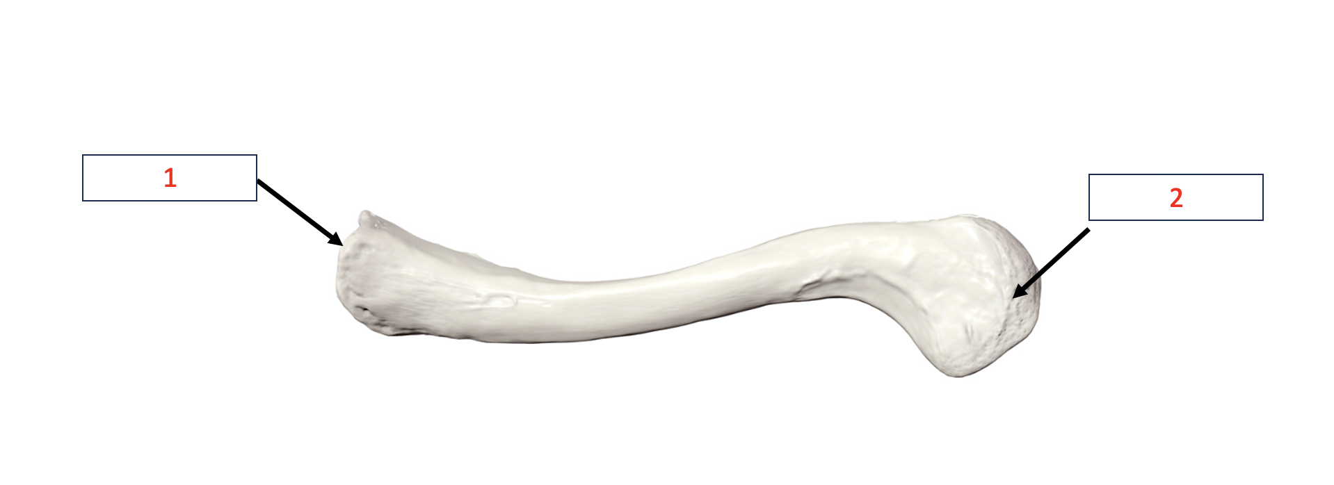 <p>Clavicle - acromial end </p>