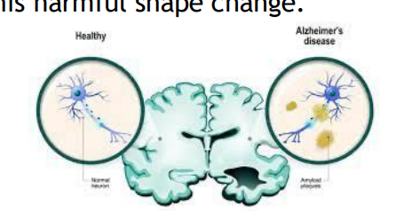 <p>[Alzheimer’s Disease]</p><p>A protein called _____may help trigger this harmful shape change.</p>