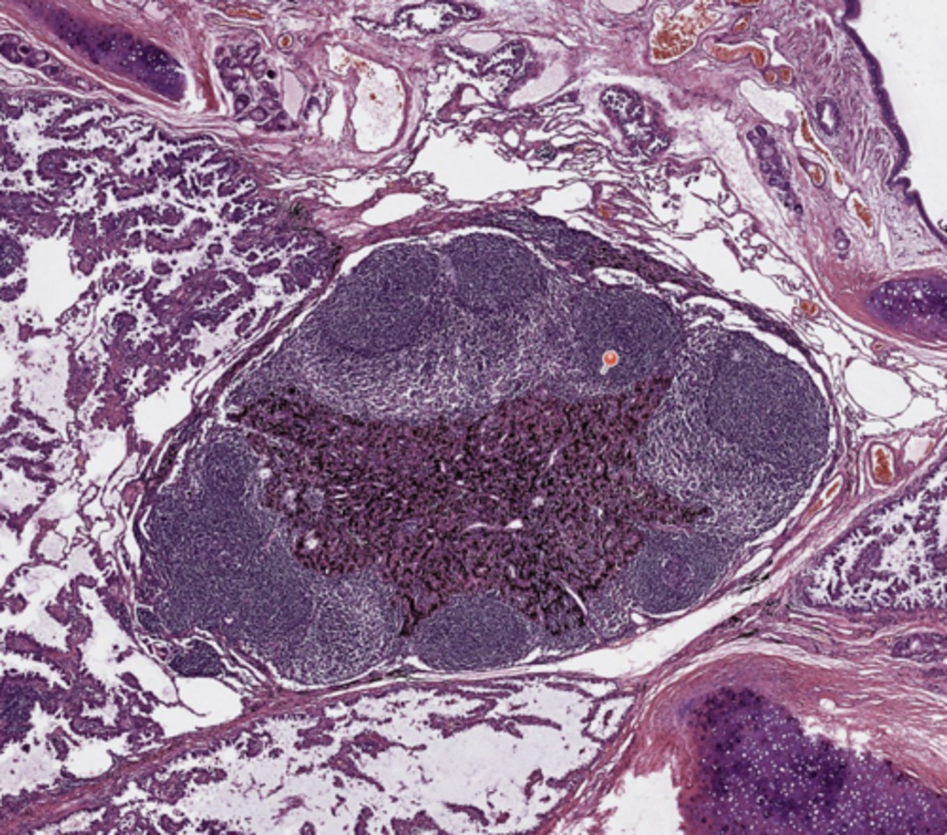 <p>Lung</p>