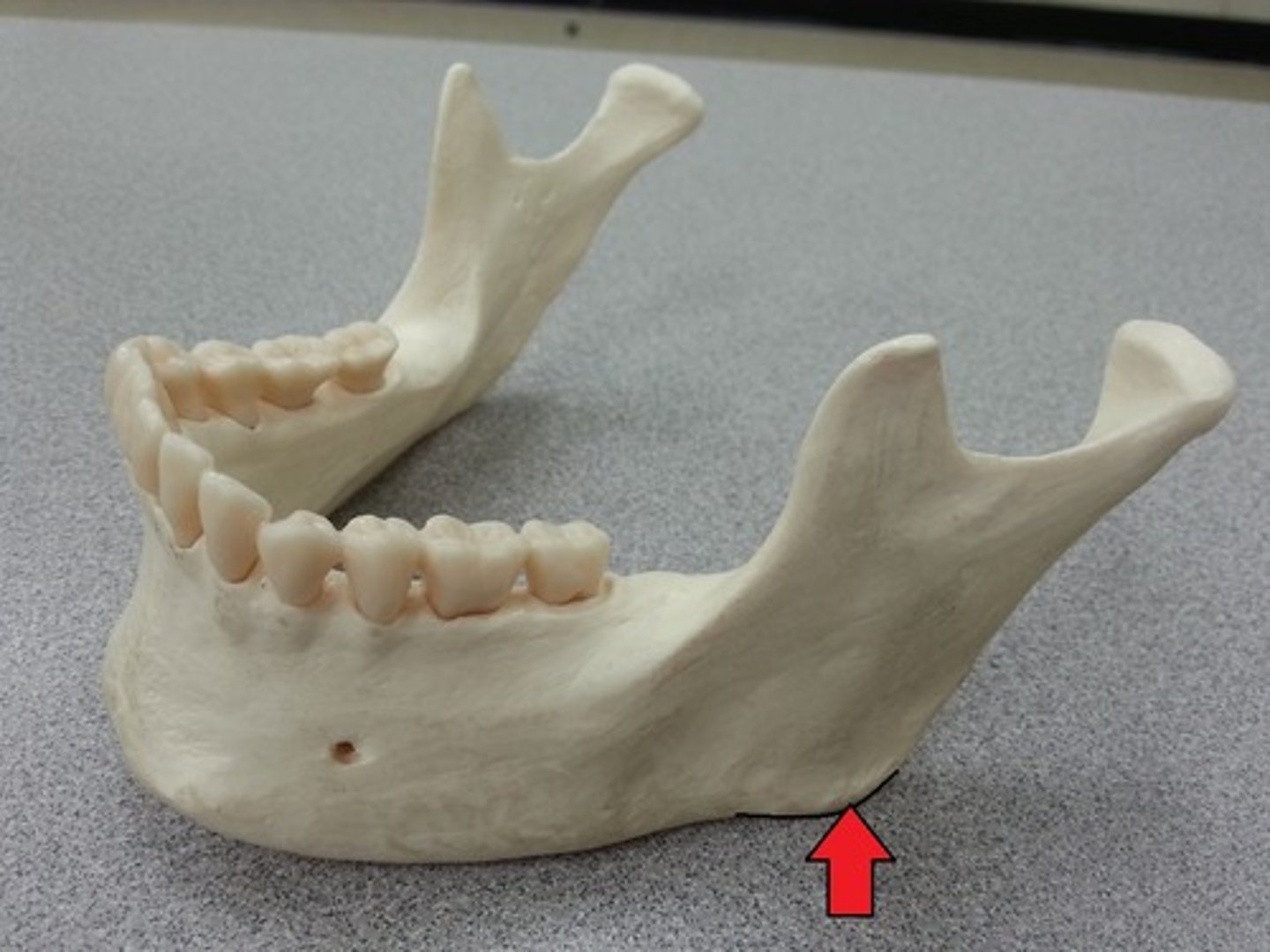 <p>What feature on the mandible is this? (External)</p>