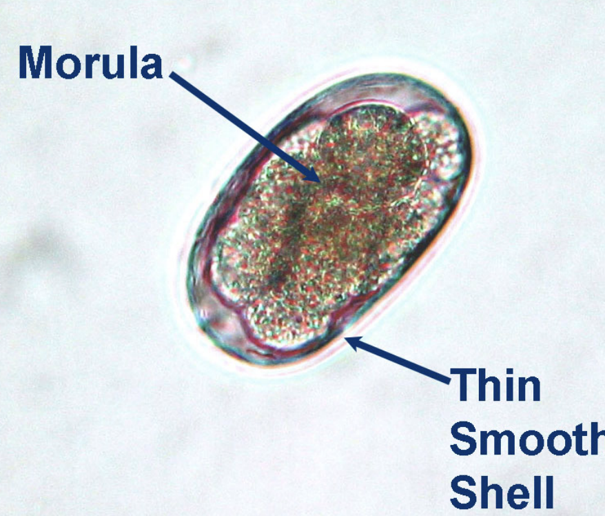 <p>What parasite egg is this?&nbsp;</p>