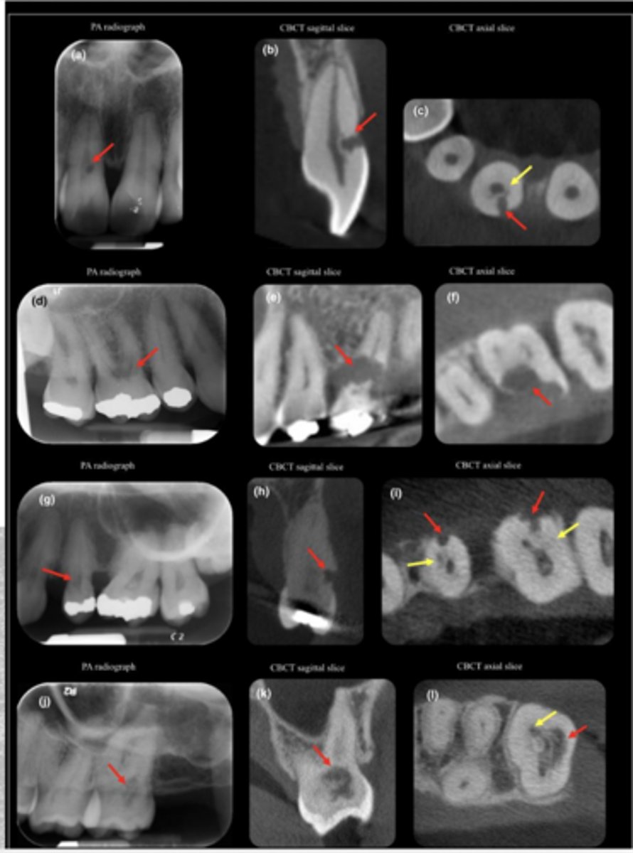 <p>ID the problem:</p>