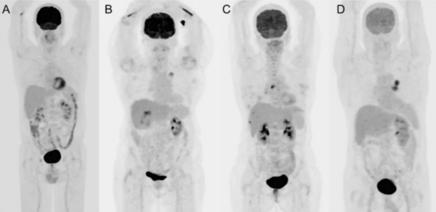 <p><span>Why do we ask the patient to <em>fast</em> before we inject?</span></p>