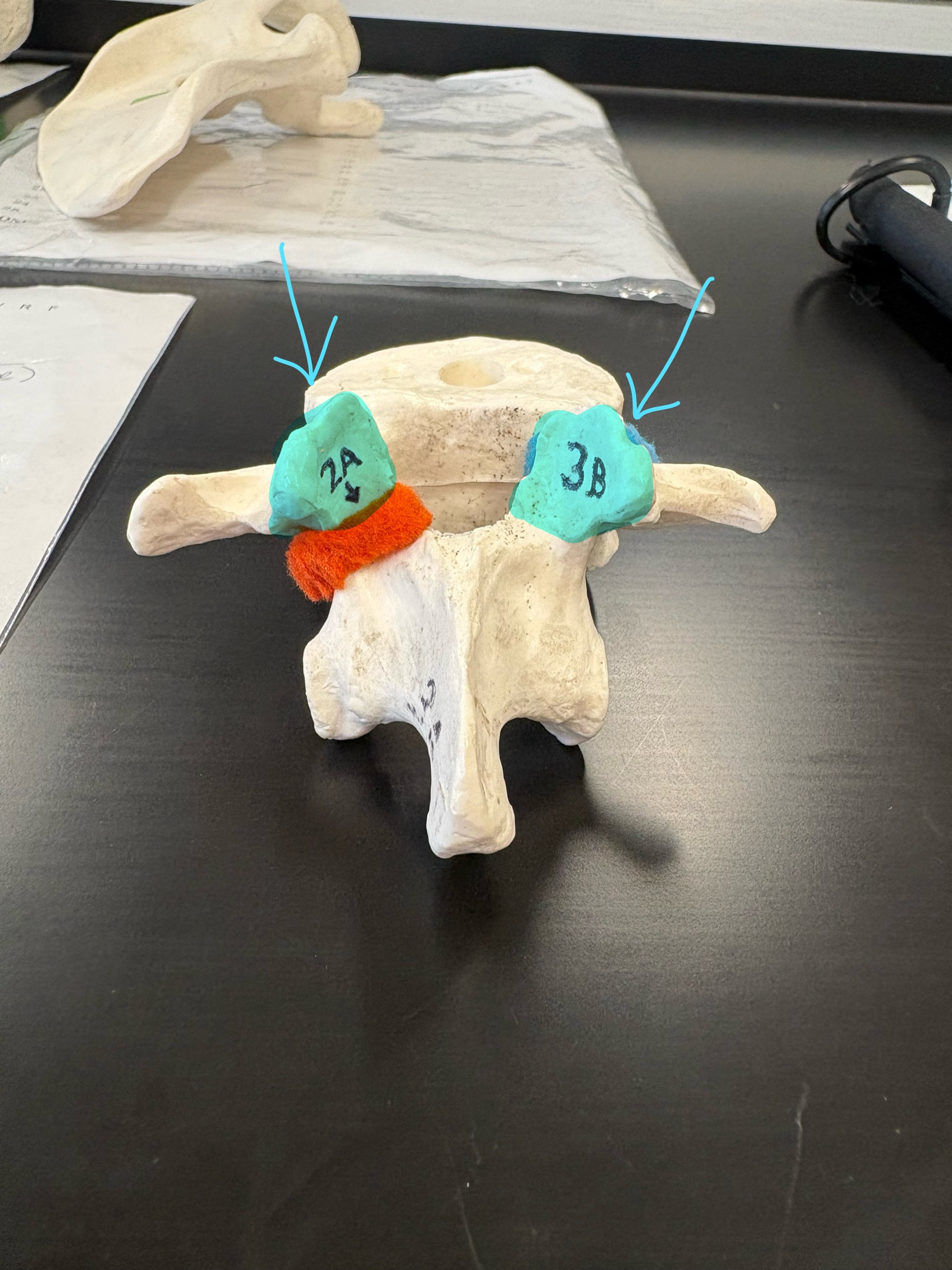 <p>Name this structure</p>