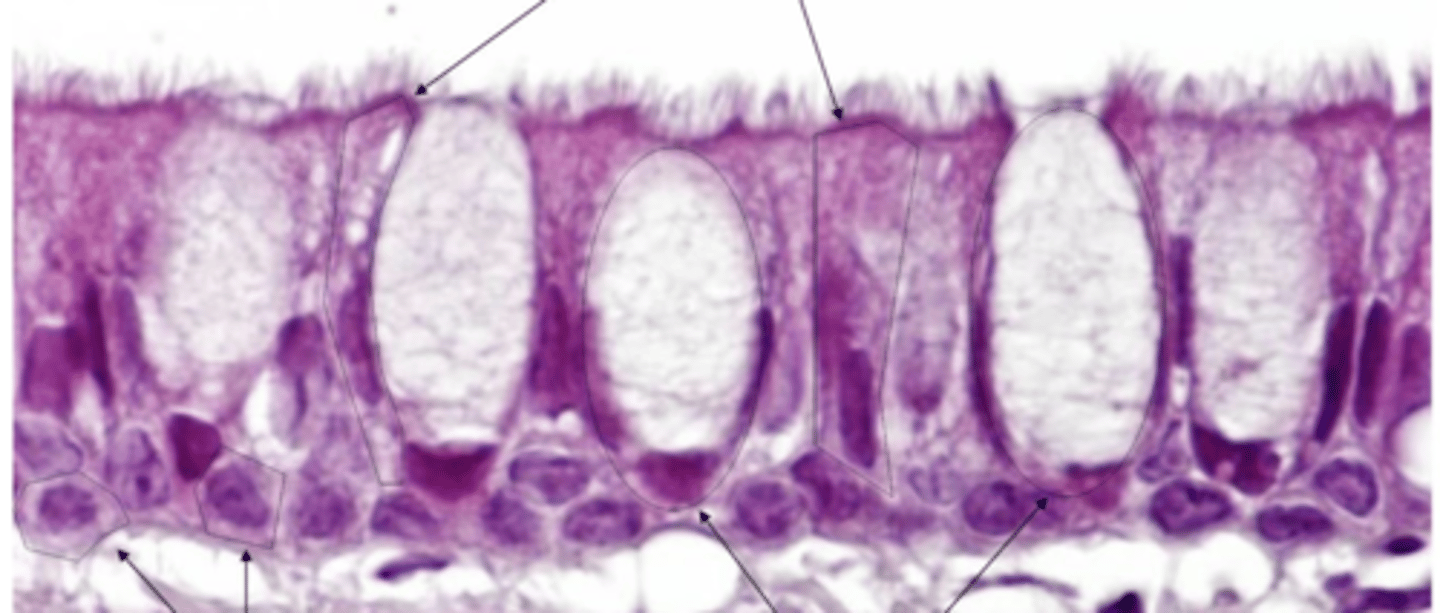 <p>what type of epithelium is this?</p>