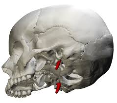 <p>temporal bones (R&L)</p>