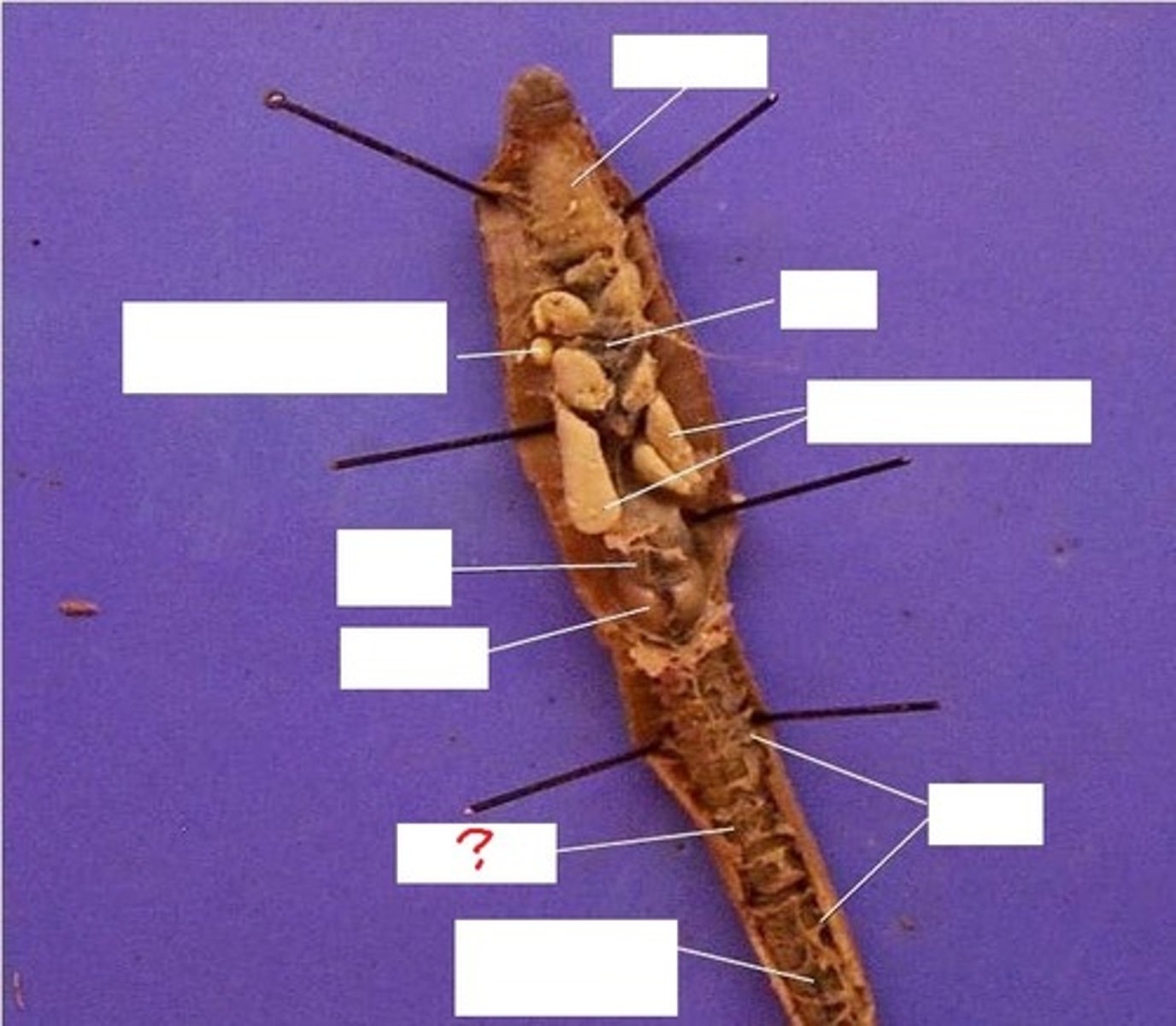 <p>What organ is this and what is it's function?</p>