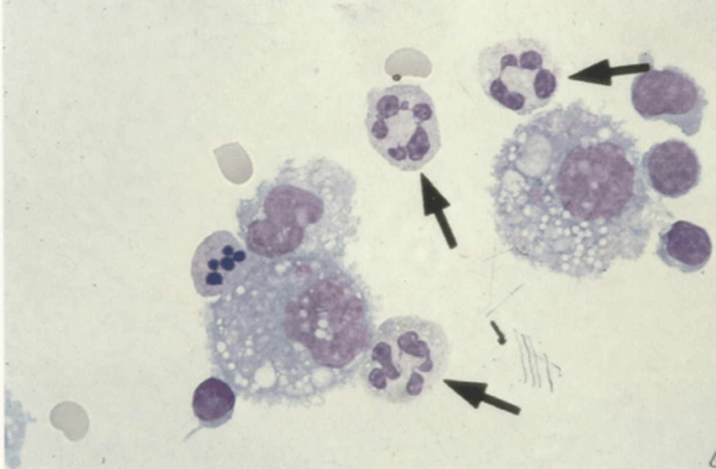 <p>Identify the cells in this body fluid</p>
