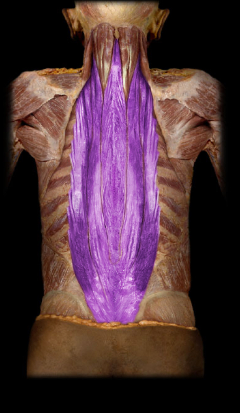 <p>Erector spinae</p>