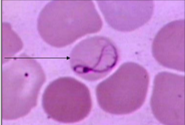 <p>Remnant microtubules of the mitotic spindle</p>