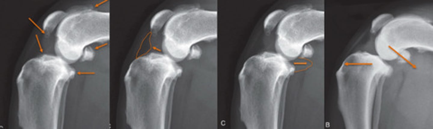 <p>What are radiographic signs of CCL disease?</p>
