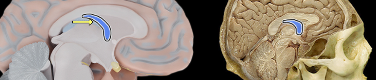 <p>Fornix of brain</p>